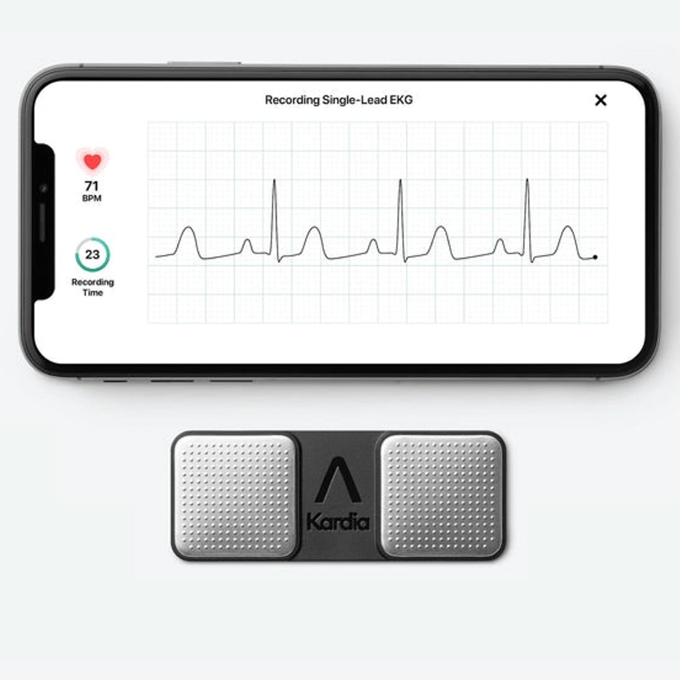 ALIVECOR Kardia Mobile